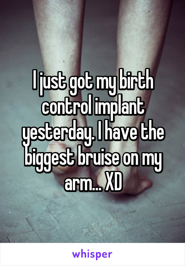 I just got my birth control implant yesterday. I have the biggest bruise on my arm... XD