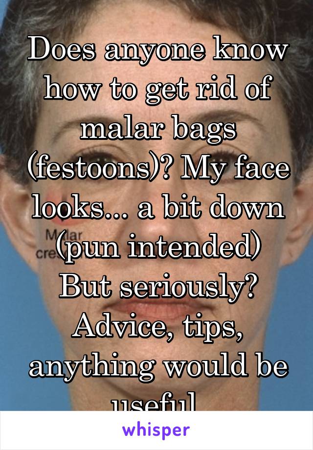 Does anyone know how to get rid of malar bags (festoons)? My face looks... a bit down (pun intended)
But seriously?
Advice, tips, anything would be useful.