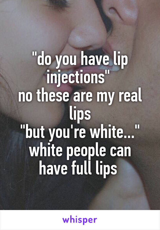 "do you have lip injections" 
no these are my real lips
"but you're white..."
white people can have full lips 