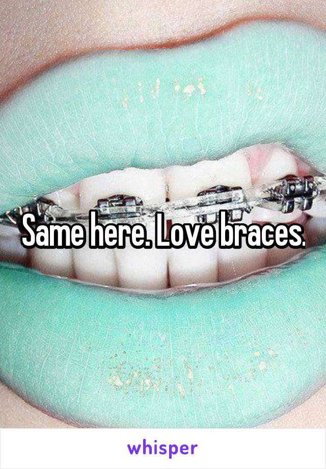 Same here. Love braces.