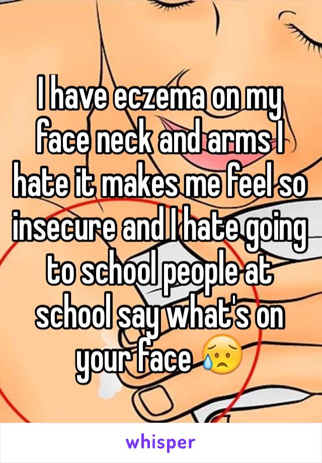 I have eczema on my face neck and arms I hate it makes me feel so insecure and I hate going to school people at school say what's on your face 😥