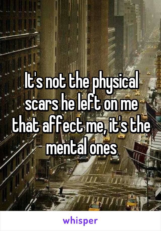 It's not the physical scars he left on me that affect me, it's the mental ones