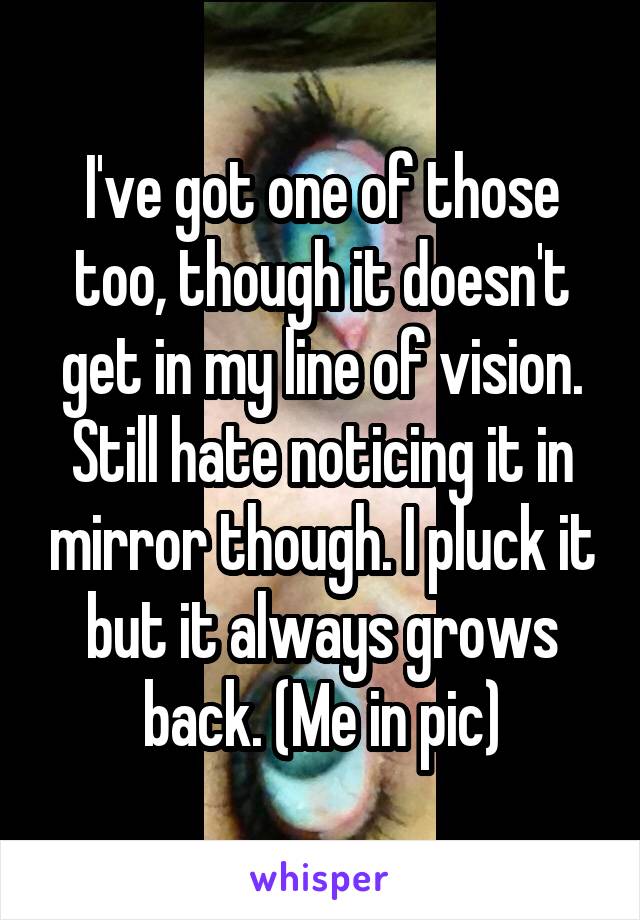 I've got one of those too, though it doesn't get in my line of vision. Still hate noticing it in mirror though. I pluck it but it always grows back. (Me in pic)