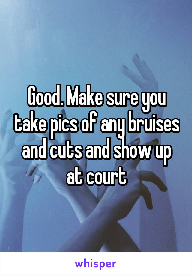 Good. Make sure you take pics of any bruises and cuts and show up at court