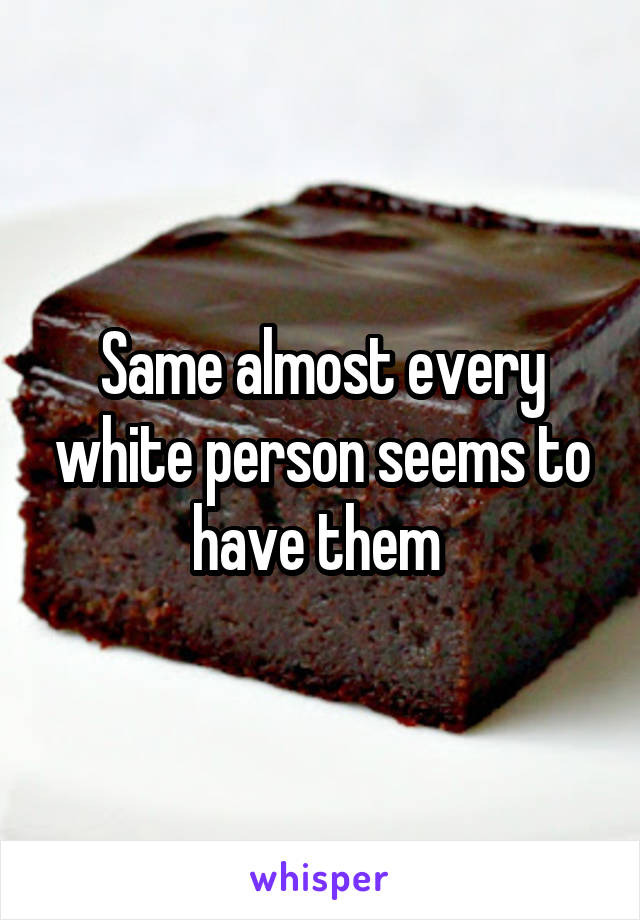 Same almost every white person seems to have them 