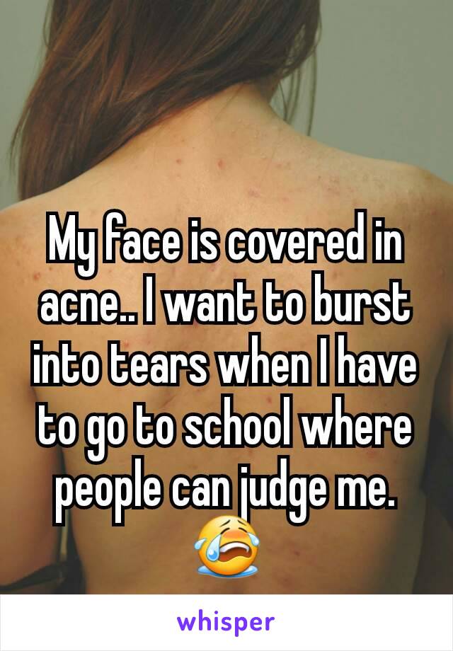 My face is covered in acne.. I want to burst into tears when I have to go to school where people can judge me. 😭