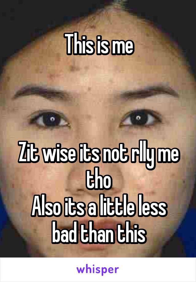 This is me



Zit wise its not rlly me tho
Also its a little less bad than this