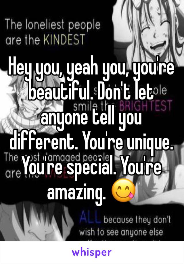 Hey you, yeah you, you're beautiful. Don't let anyone tell you different. You're unique. You're special. You're amazing. 😋