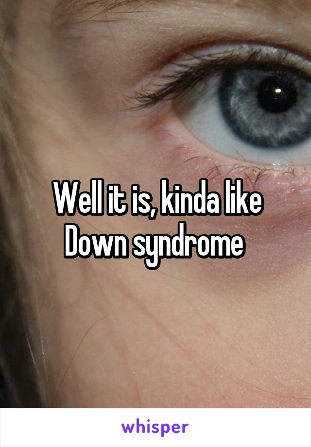 Well it is, kinda like Down syndrome 