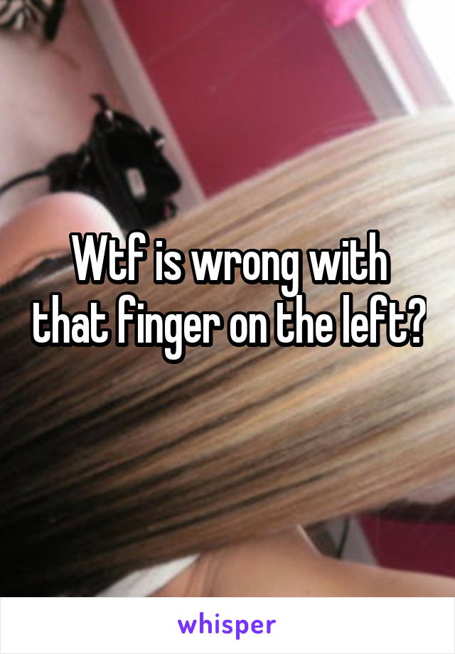 Wtf is wrong with that finger on the left? 