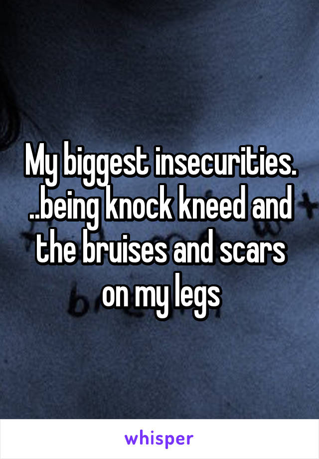 My biggest insecurities. ..being knock kneed and the bruises and scars on my legs