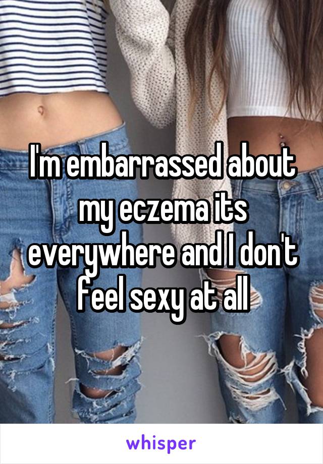 I'm embarrassed about my eczema its everywhere and I don't feel sexy at all