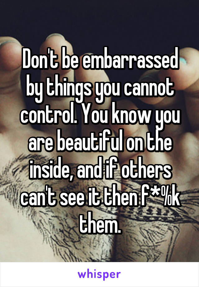 Don't be embarrassed by things you cannot control. You know you are beautiful on the inside, and if others can't see it then f*%k them.
