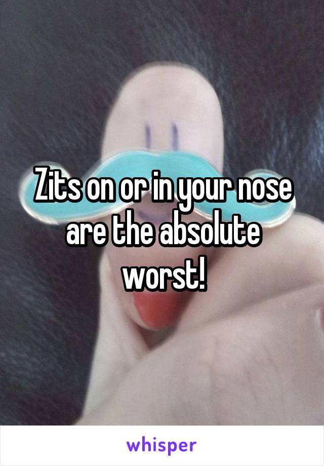 Zits on or in your nose are the absolute worst!