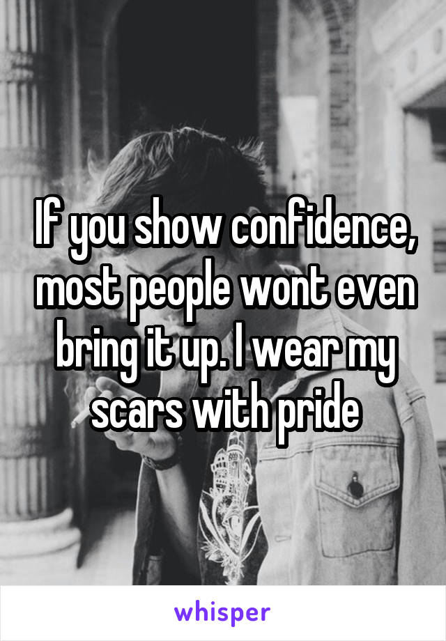 If you show confidence, most people wont even bring it up. I wear my scars with pride