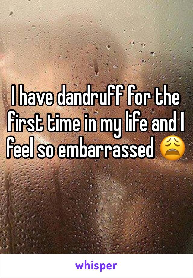 I have dandruff for the first time in my life and I feel so embarrassed 😩 