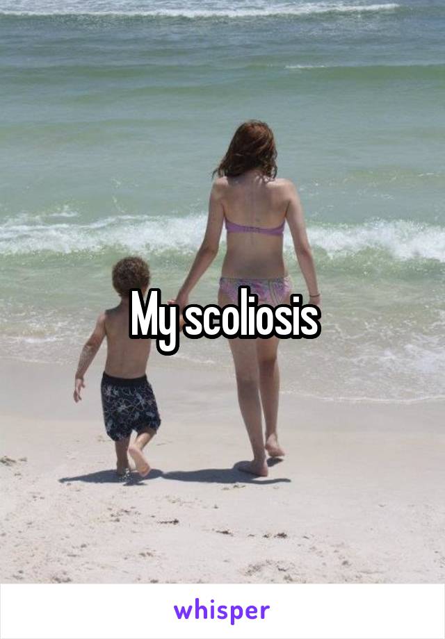 My scoliosis