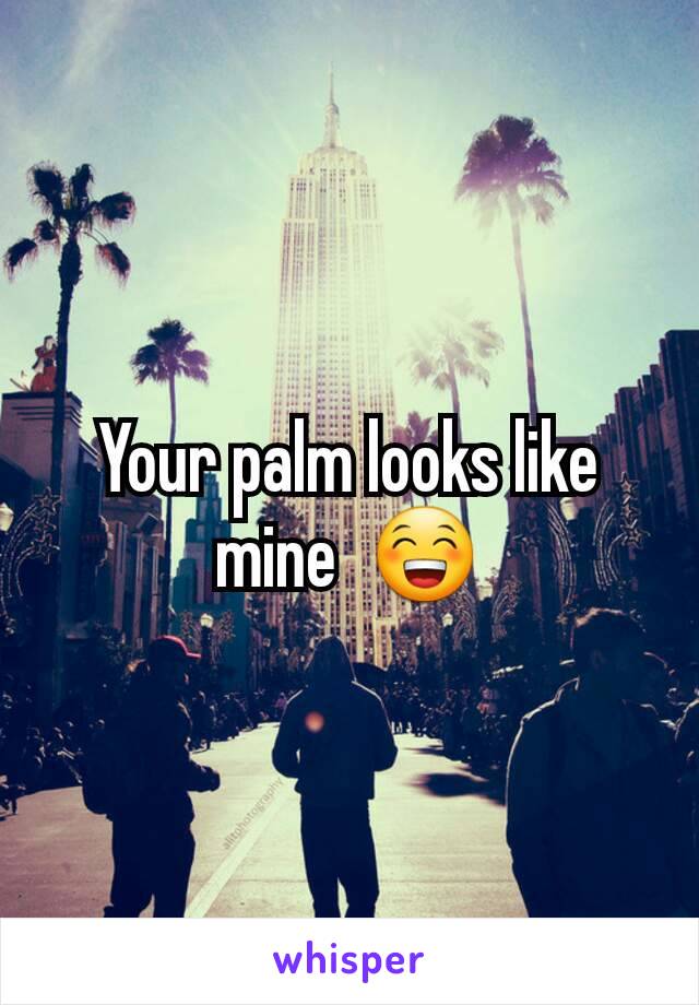 Your palm looks like mine  😁