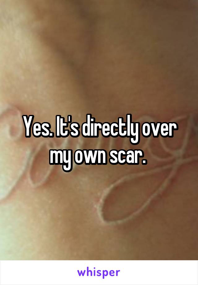 Yes. It's directly over my own scar. 