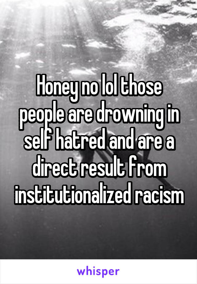 Honey no lol those people are drowning in self hatred and are a direct result from institutionalized racism