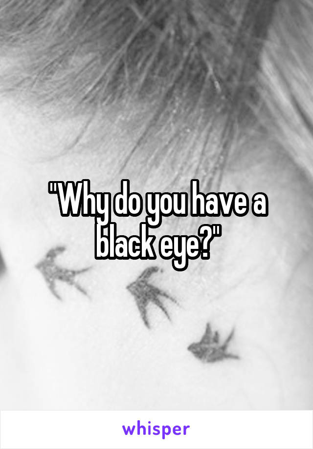 "Why do you have a black eye?"
