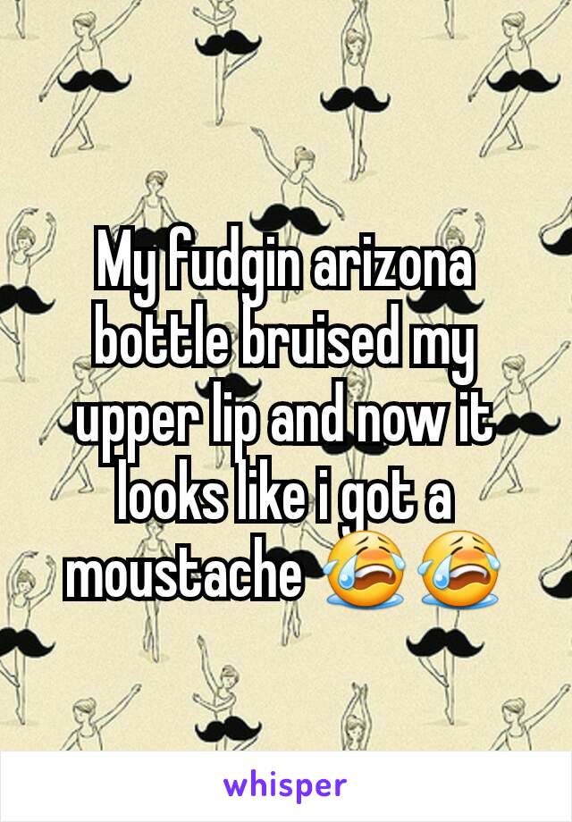 My fudgin arizona bottle bruised my upper lip and now it looks like i got a moustache 😭😭