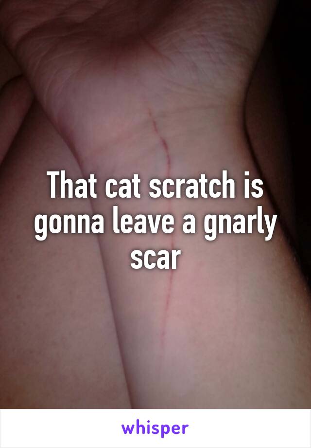 That cat scratch is gonna leave a gnarly scar