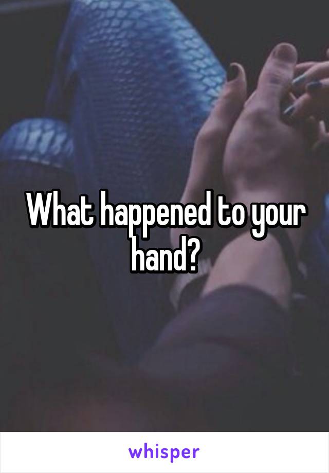 What happened to your hand?