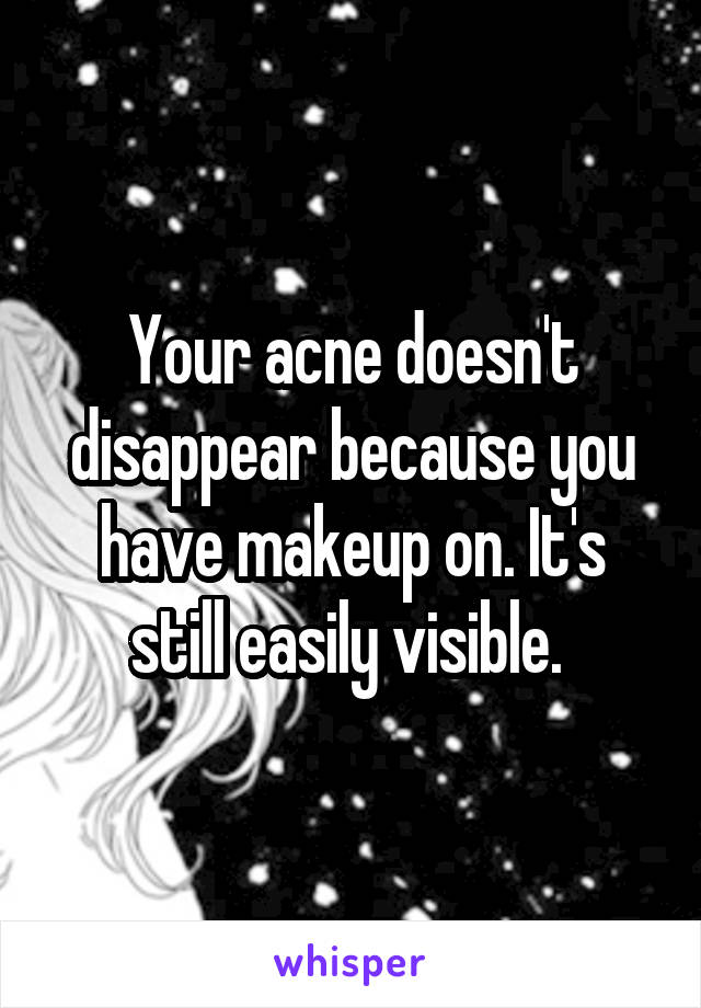 Your acne doesn't disappear because you have makeup on. It's still easily visible. 