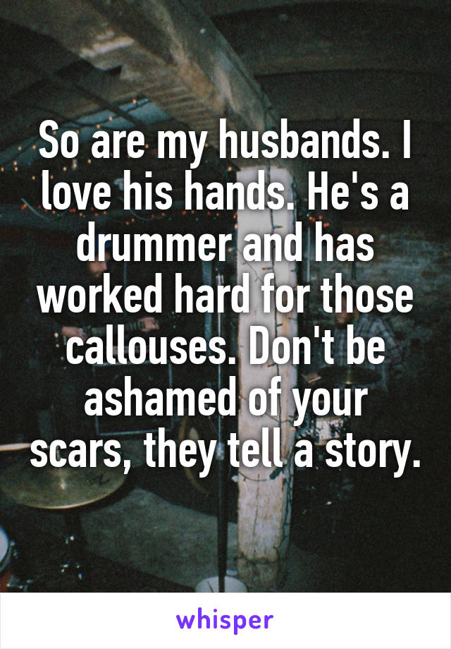 So are my husbands. I love his hands. He's a drummer and has worked hard for those callouses. Don't be ashamed of your scars, they tell a story. 