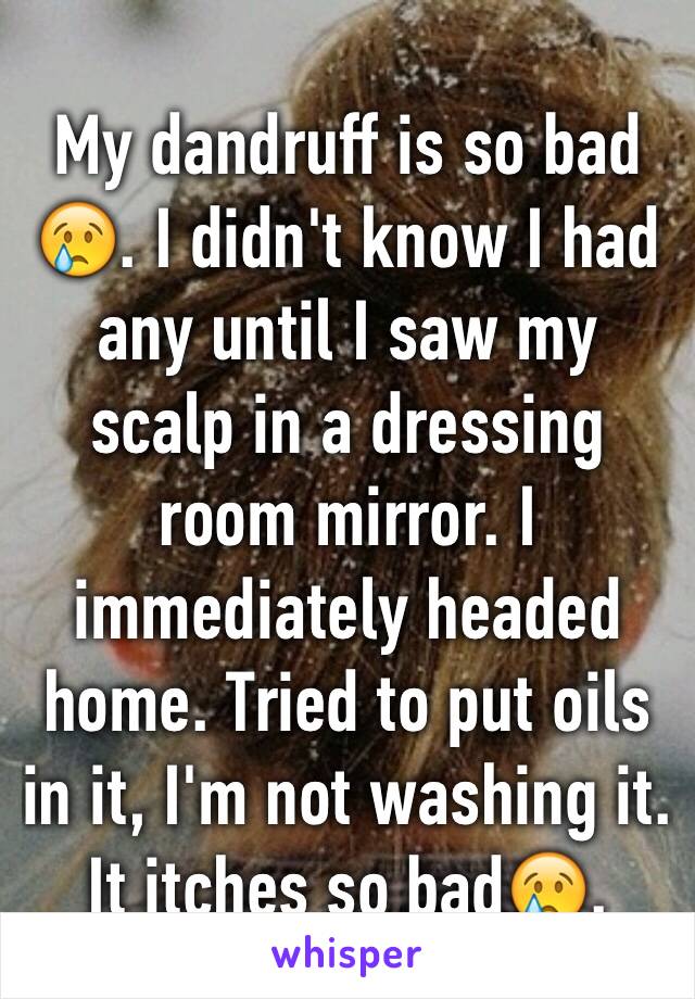 My dandruff is so bad ðŸ˜¢. I didn't know I had any until I saw my scalp in a dressing room mirror. I immediately headed home. Tried to put oils in it, I'm not washing it. It itches so badðŸ˜¢.