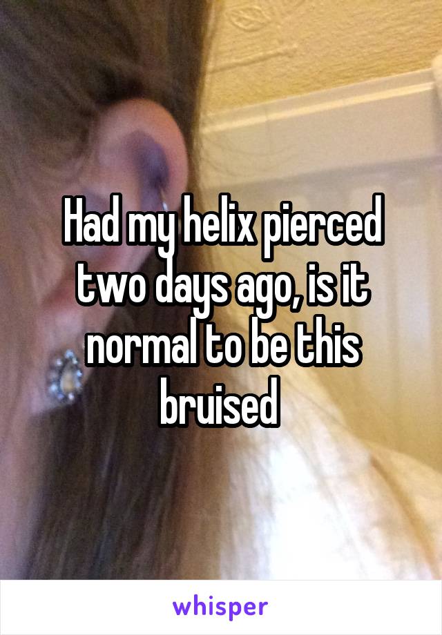 Had my helix pierced two days ago, is it normal to be this bruised 