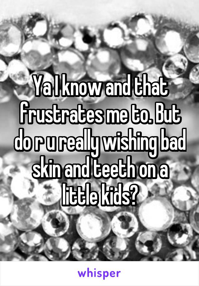 Ya I know and that frustrates me to. But do r u really wishing bad skin and teeth on a little kids?