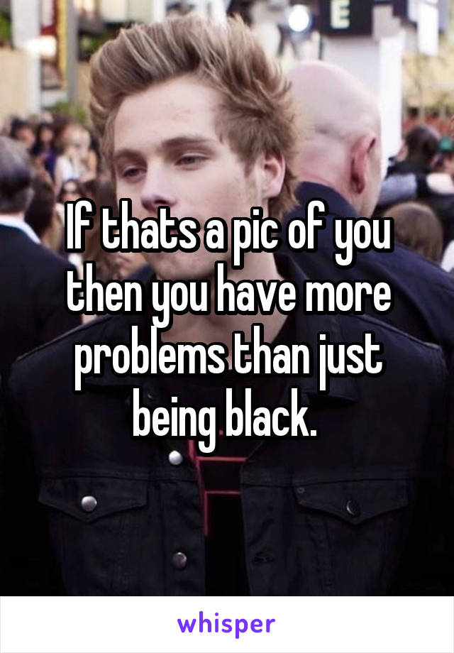 If thats a pic of you then you have more problems than just being black. 