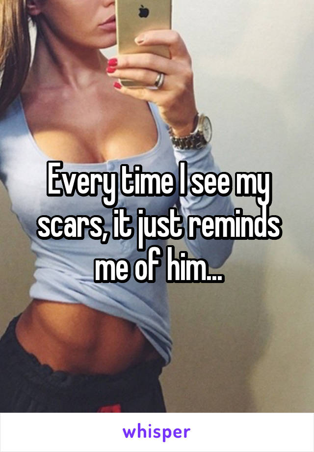 Every time I see my scars, it just reminds me of him...