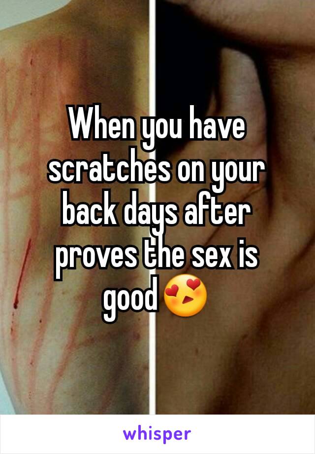 When you have scratches on your back days after proves the sex is good😍