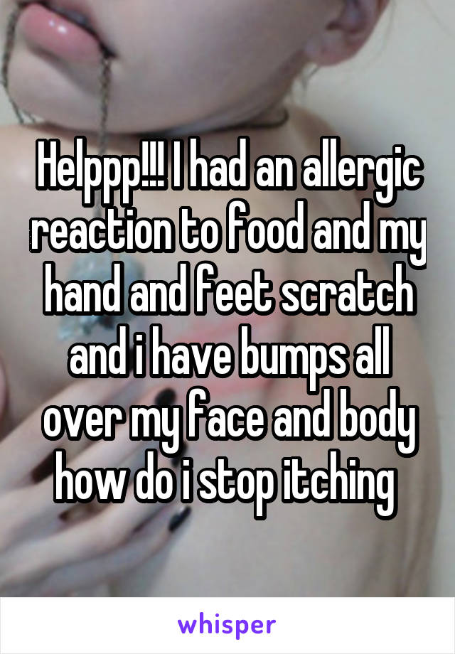 Helppp!!! I had an allergic reaction to food and my hand and feet scratch and i have bumps all over my face and body how do i stop itching 