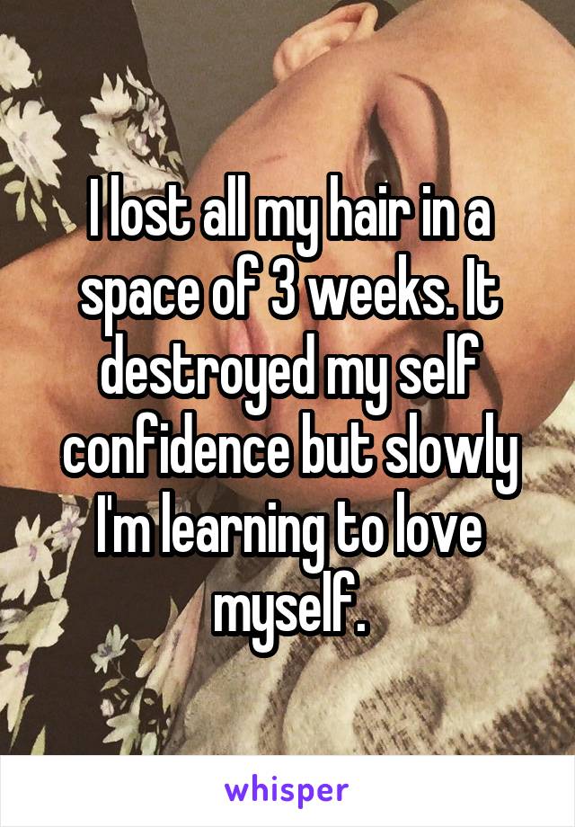 I lost all my hair in a space of 3 weeks. It destroyed my self confidence but slowly I'm learning to love myself.