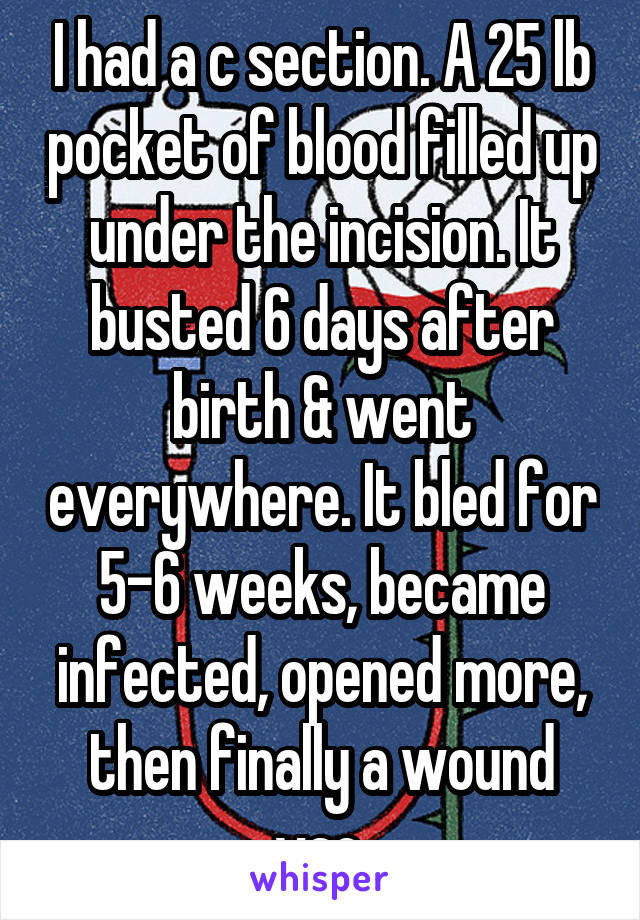 I had a c section. A 25 lb pocket of blood filled up under the incision. It busted 6 days after birth & went everywhere. It bled for 5-6 weeks, became infected, opened more, then finally a wound vac.