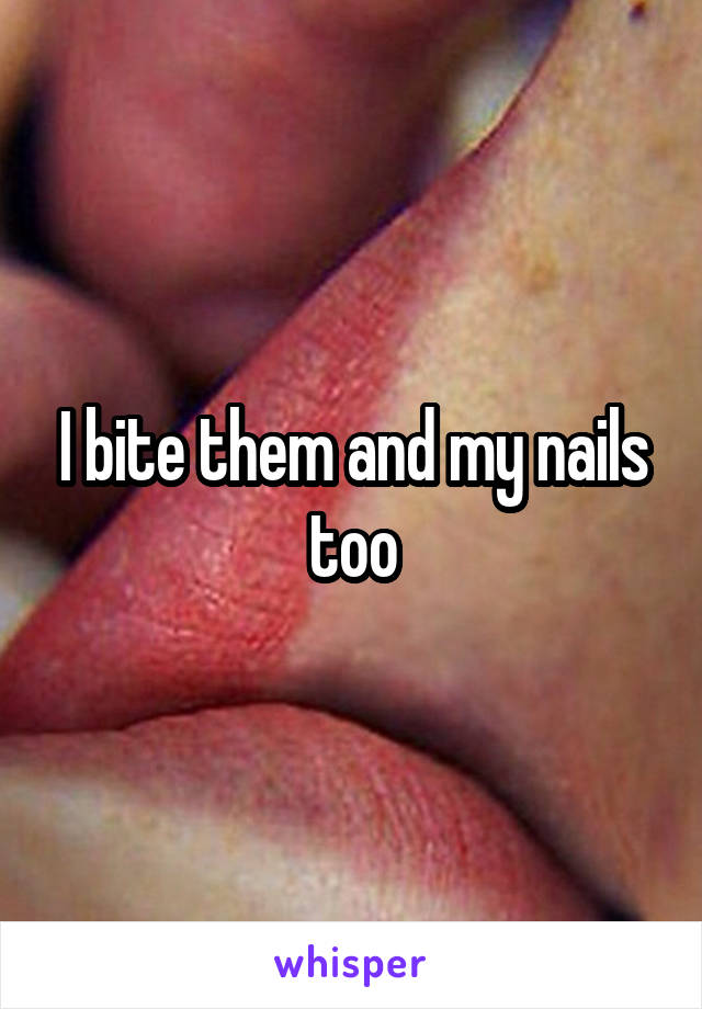 I bite them and my nails too