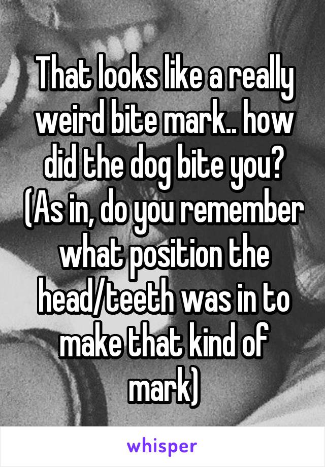 That looks like a really weird bite mark.. how did the dog bite you? (As in, do you remember what position the head/teeth was in to make that kind of mark)