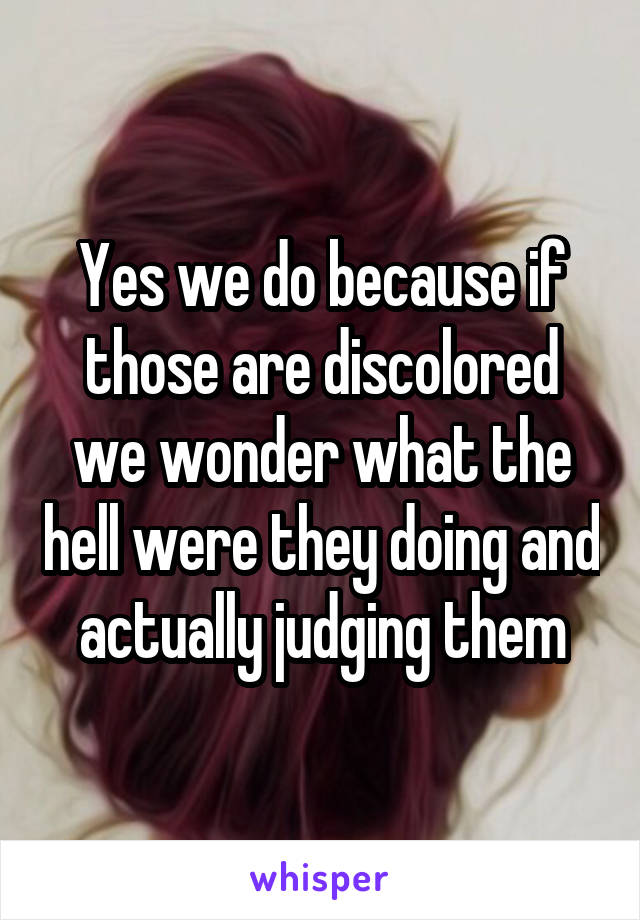 Yes we do because if those are discolored we wonder what the hell were they doing and actually judging them