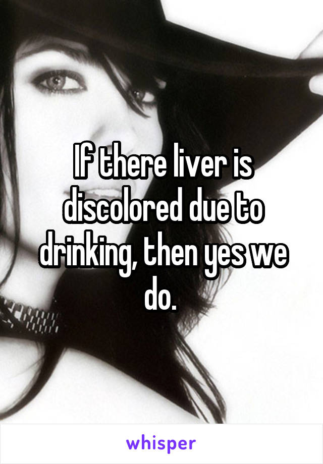 If there liver is discolored due to drinking, then yes we do. 