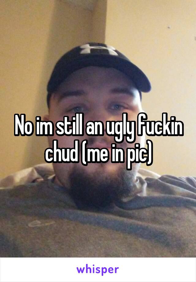 No im still an ugly fuckin chud (me in pic)