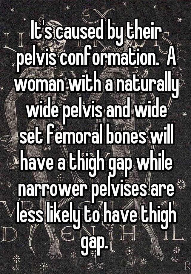 it-s-caused-by-their-pelvis-conformation-a-woman-with-a-naturally-wide