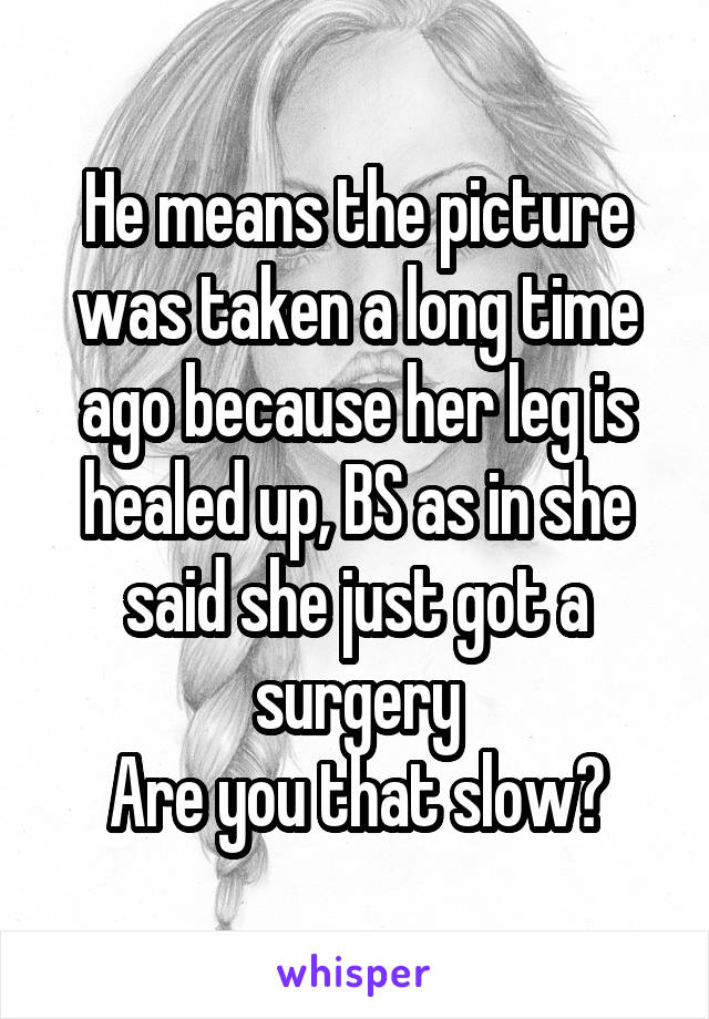 He means the picture was taken a long time ago because her leg is healed up, BS as in she said she just got a surgery
Are you that slow?