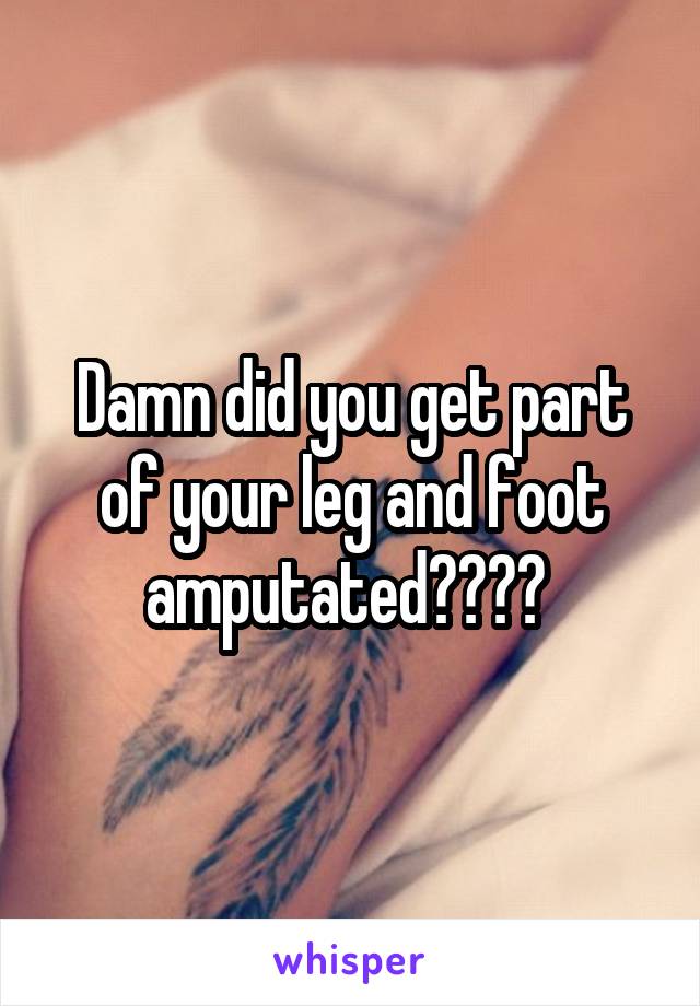 Damn did you get part of your leg and foot amputated???? 