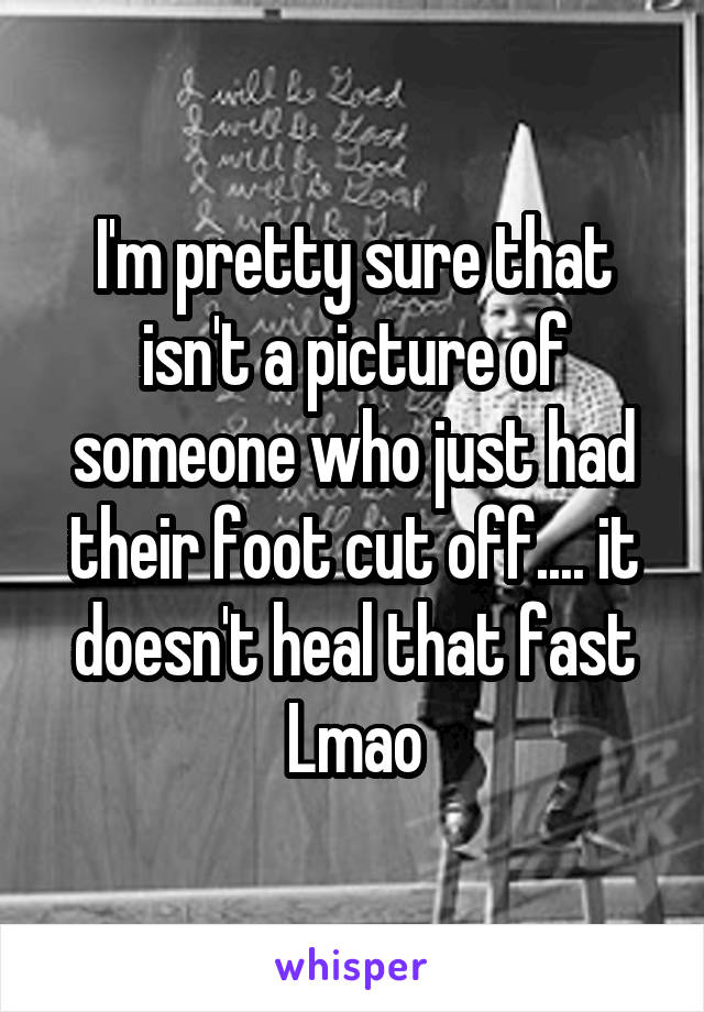 I'm pretty sure that isn't a picture of someone who just had their foot cut off.... it doesn't heal that fast
Lmao