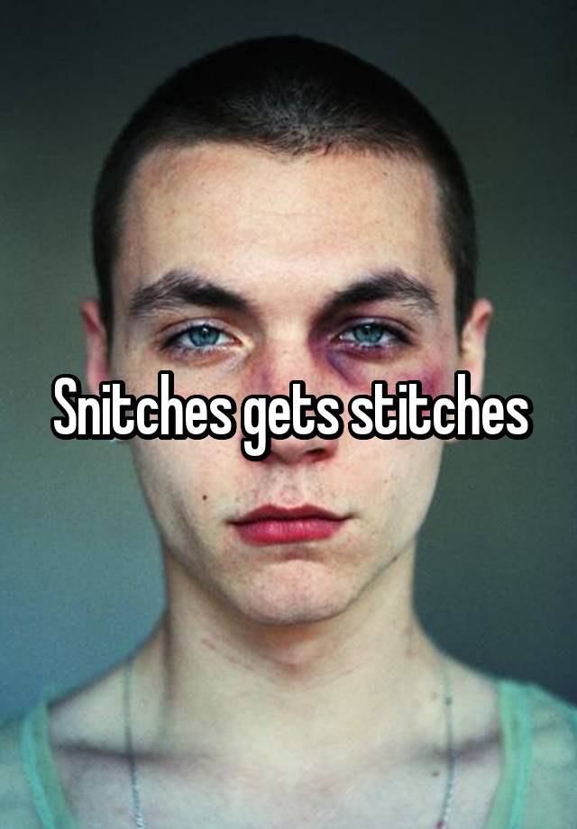 Snitches Gets Stitches 5880