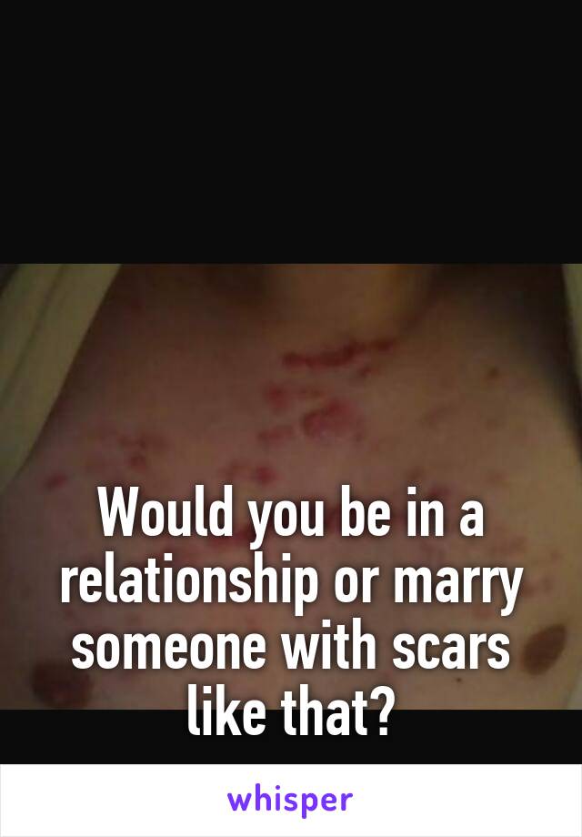 





Would you be in a relationship or marry someone with scars like that?